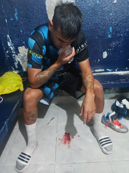 Se suspendió la final entre Jorge Newbery y Deportivo Rincon: el equipo visitante fue agredido previo al partido