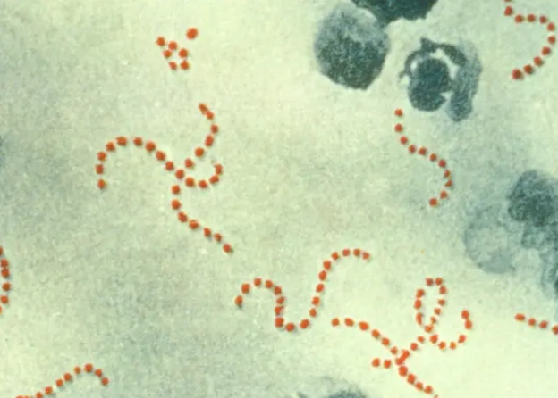 enfermedad-bacteriana-8943 enfermedad-bacteriana-8943