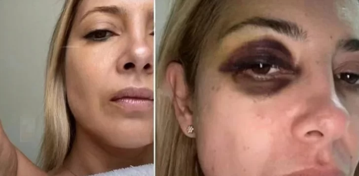 Las fotos y chats de la denuncia de Fabiola Yañez contra Alberto Fernández: “Venís golpeándome hace 3 días seguidos”