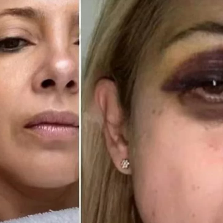 Las fotos y chats de la denuncia de Fabiola Yañez contra Alberto Fernández: “Venís golpeándome hace 3 días seguidos”