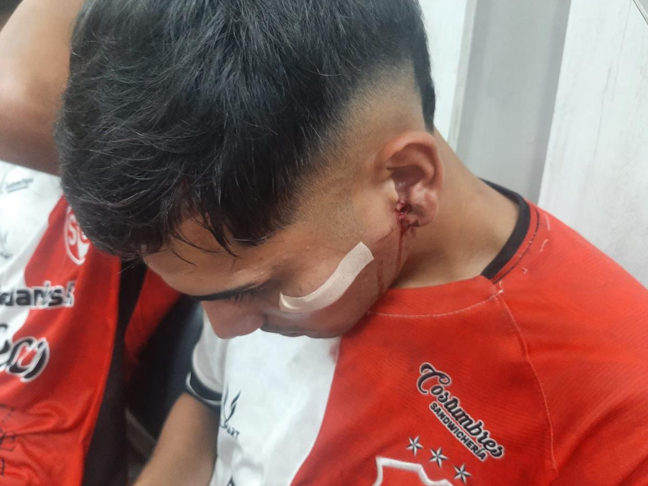 violencia-futbol-tucuman-34-1-728x546