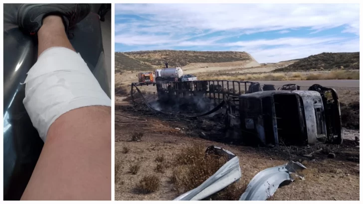 Bombero héroe se lesionó en el incendio de Ruta 3 provocado tras el vuelco de un camión
