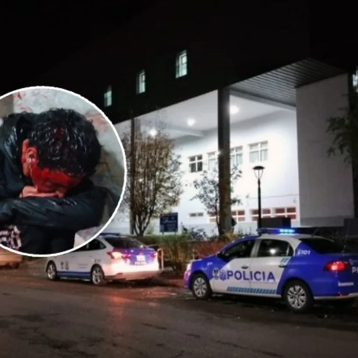 Dieron de alta al ladrón que había sido sometido a golpes por un vecino: fijó domicilio y recuperó su libertad Dieron de alta al ladrón que había sido sometido a golpes por un vecino: fijó domicilio y recuperó su libertad