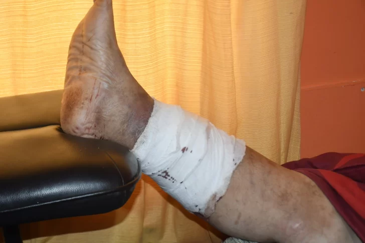 maceta-se-recupera-problema-ulcera-2-728x485