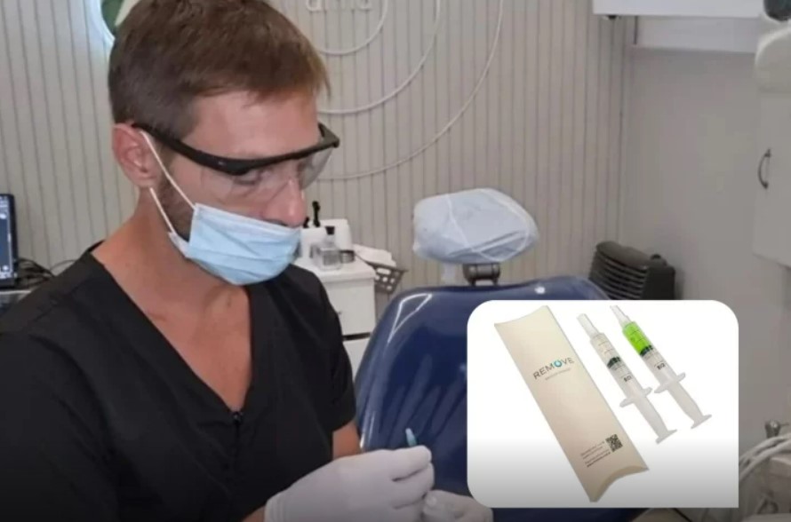 odontologo-caries-728x481