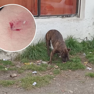 Vecinos denuncian reiterados ataques de dos perros sueltos cerca de la Autovía: “El dueño no se hace cargo”