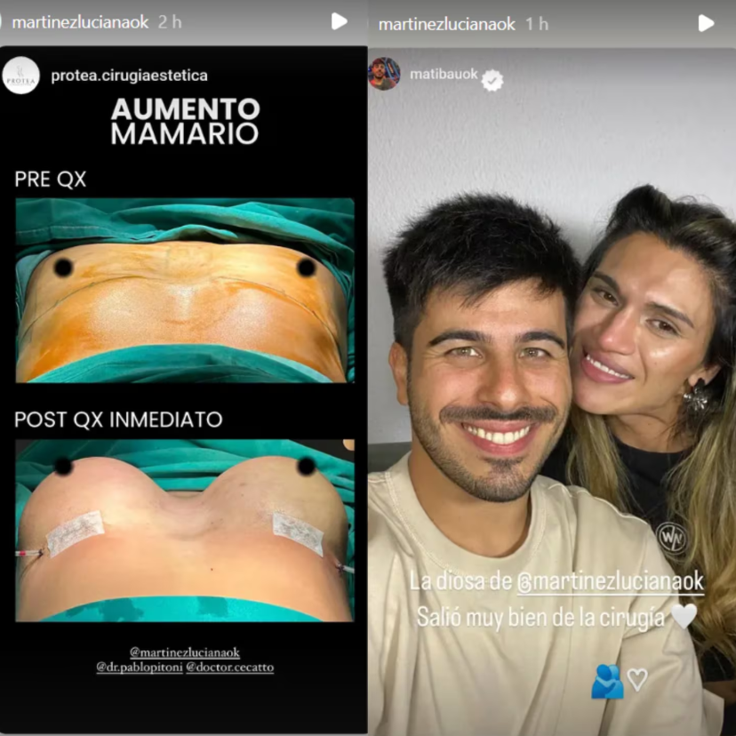 Luciana Martínez de Gran Hermano se realizó su primera cirugía en su proceso de transición de género