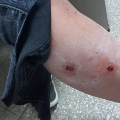 Fue atacada por tres perros y pide responsabilidad: “Es cansador tener que caminar con miedo”