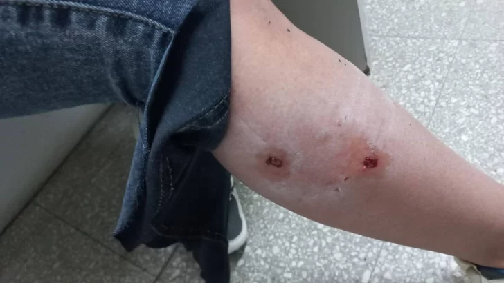 Fue atacada por tres perros y pide responsabilidad: “Es cansador tener que caminar con miedo”