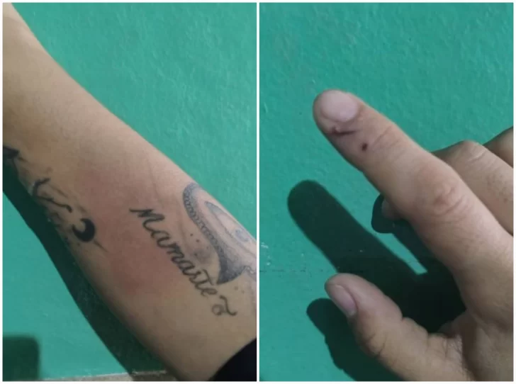 El drama de la docente que fue golpeada y amenazada por un delincuente: “Tengo miedo y él sigue robando”