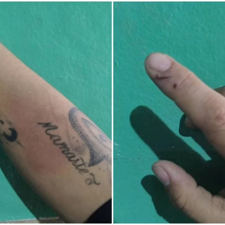 El drama de la docente que fue golpeada y amenazada por un delincuente: “Tengo miedo y él sigue robando”