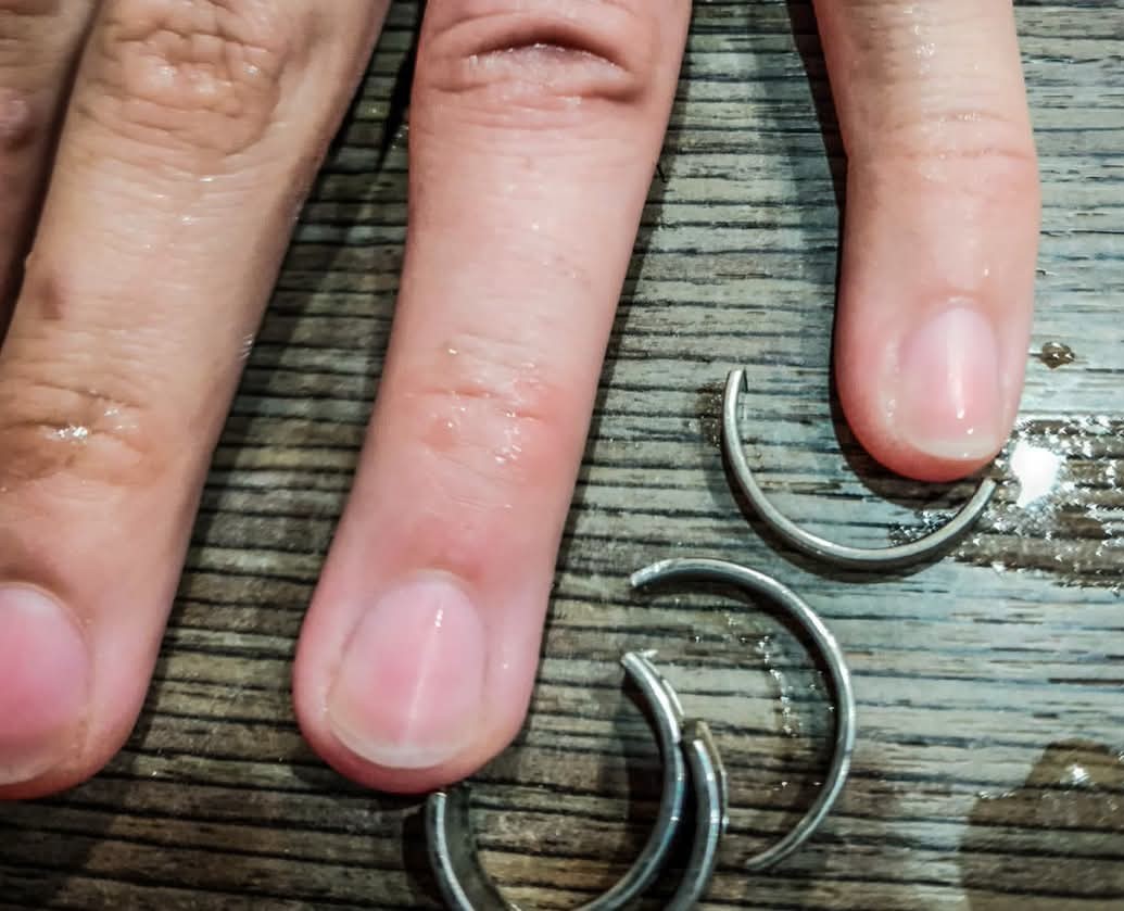  El anillo y la mano tras haber sido liberada. (FOTO: POLICÍA SANTA CRUZ)