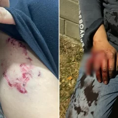 “Casi me mataron”, declaró el vecino que fue acorralado y atacado por dos perros pitbulls en Caleta Olivia