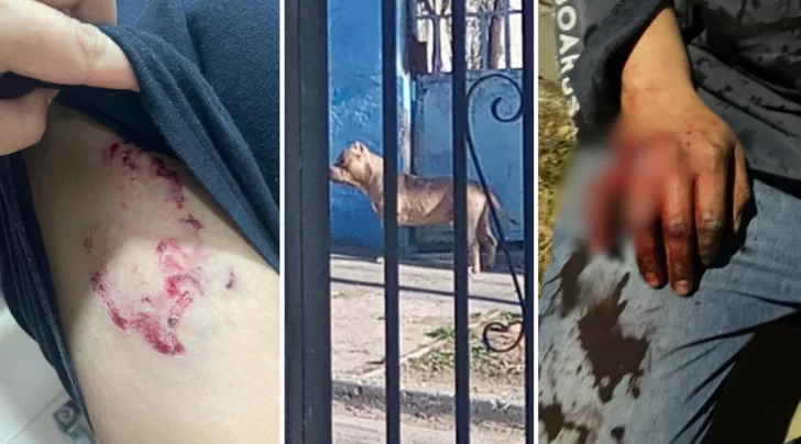 El juez de Faltas de Caleta Olivia ordenó la eutanasia para los pitbulls que atacaron a un vecino del barrio Parque
