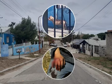 Ataque de dos pitbulls a un vecino de Caleta Olivia: “Se llevaron a los perros y desaparecieron del barrio”