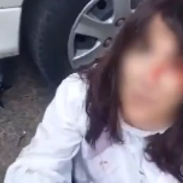 Se olvidó de poner el freno de mano y terminó atropellada por su propio auto