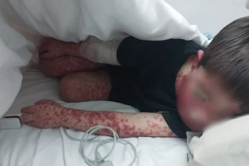 Noah tiene 4 años y una enfermedad desconocida: juntan dinero para cubrir los gastos de la derivación