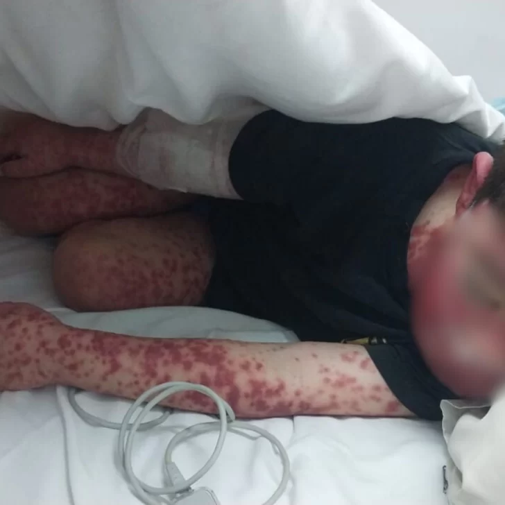 Noah tiene 4 años y una enfermedad desconocida: juntan dinero porque OSPE no cubre los gastos
