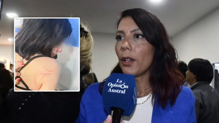 Sara Delgado confirmó que echaron a la “guardia urbana” que dio una golpiza: “Ni bien supimos, la desafectamos”
