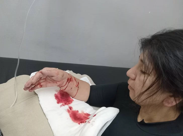  Así ingresó Viviana Velásquez este domingo a la guardia del Hospital Regional Río Gallegos.