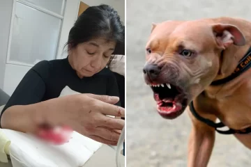 Un pitbull atacó a una runner en la costanera y terminó en el quirófano: “Le destrozó el brazo” Un pitbull atacó a una runner en la costanera y terminó en el quirófano: “Le destrozó el brazo”