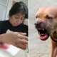 Un pitbull atacó a una runner en la costanera y terminó en el quirófano: "Le destrozó el brazo"