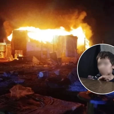 El nene del incendio en barrio Patagonia mejora: “Ya puede comer, pero lo volvieron a dormir para que no sienta dolor”