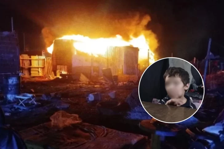 El nene del incendio en barrio Patagonia mejora: “Ya puede comer, pero lo volvieron a dormir para que no sienta dolor”