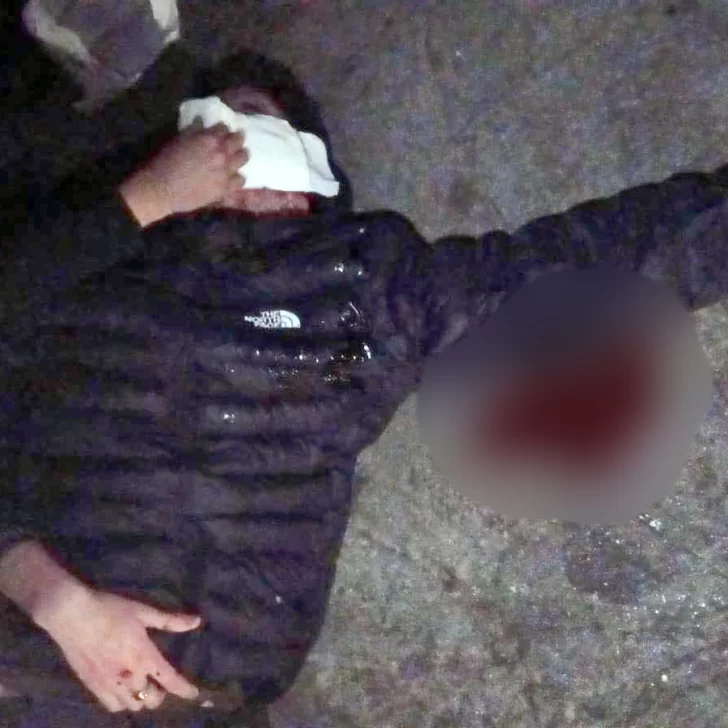 “No podemos seguir naturalizando que un pibe de 18 años lo manden al hospital y quede así “No podemos seguir naturalizando que un pibe de 18 años lo manden al hospital y quede así