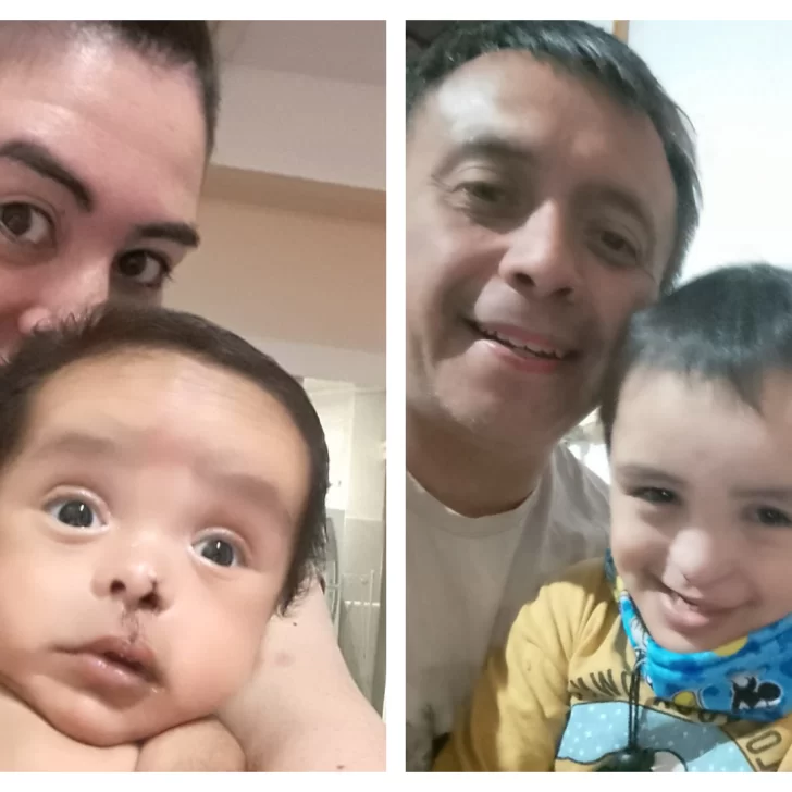 Día Provincial de FLAP: alrededor de 200 pacientes esperan atención en Santa Cruz Día Provincial de FLAP: alrededor de 200 pacientes esperan atención en Santa Cruz