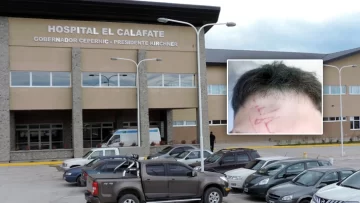 El peor Día del Amigo: un joven quedó hospitalizado tras recibir una brutal golpiza en El Calafate El peor Día del Amigo: un joven quedó hospitalizado tras recibir una brutal golpiza en El Calafate