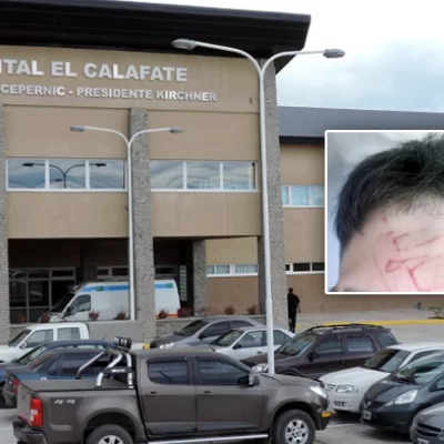 Un joven quedó hospitalizado tras recibir una brutal golpiza en El Calafate