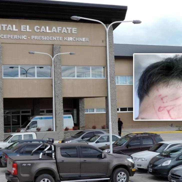 El peor Día del Amigo: un joven quedó hospitalizado tras recibir una brutal golpiza en El Calafate El peor Día del Amigo: un joven quedó hospitalizado tras recibir una brutal golpiza en El Calafate