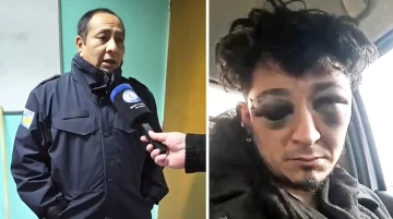 El ministro Pródromos habló del músico golpeado por policía: “Vamos a ir hasta las últimas consecuencias” El ministro Pródromos habló del músico golpeado por policía: “Vamos a ir hasta las últimas consecuencias”