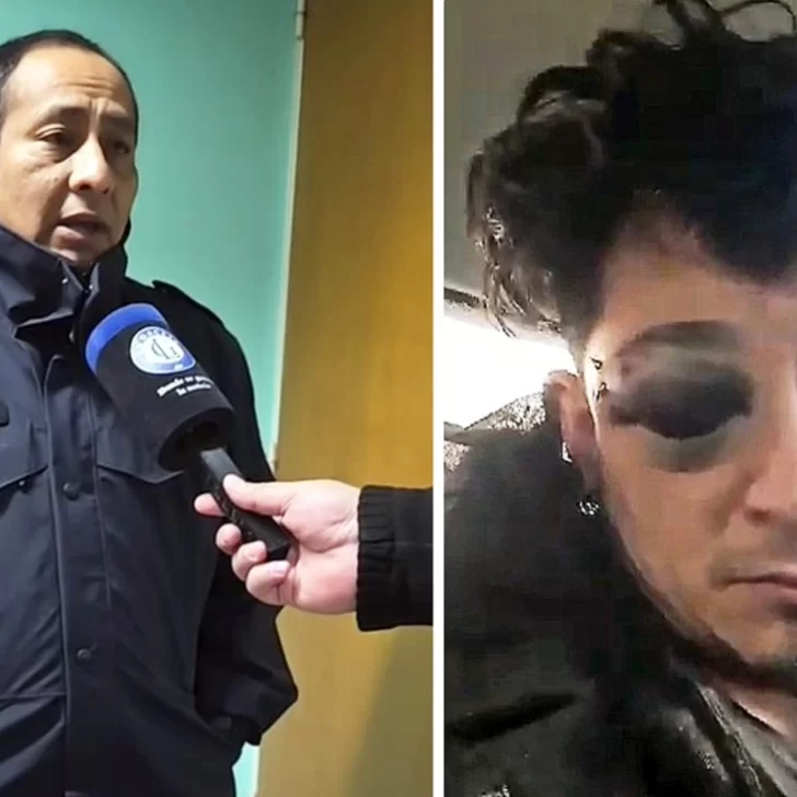 El ministro Pródromos habló del músico golpeado por policía: “Vamos a ir hasta las últimas consecuencias” El ministro Pródromos habló del músico golpeado por policía: “Vamos a ir hasta las últimas consecuencias”