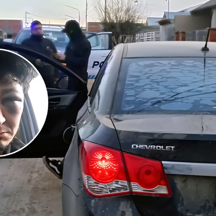 Brutal golpiza a un músico en Pico Truncado: “Esto no puede volver a pasar nunca más” Brutal golpiza a un músico en Pico Truncado: “Esto no puede volver a pasar nunca más”