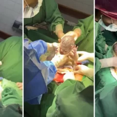 Un caso que ocurre cada un millón: nacieron trigemelas en Salta