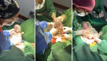 Un caso que ocurre cada un millón: nacieron trigemelas en Salta Un caso que ocurre cada un millón: nacieron trigemelas en Salta