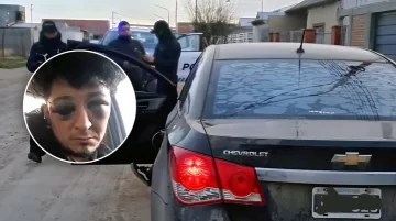 A un mes de la brutal golpiza a un músico en Pico Truncado: “La Policía me quiso matar” A un mes de la brutal golpiza a un músico en Pico Truncado: “La Policía me quiso matar”