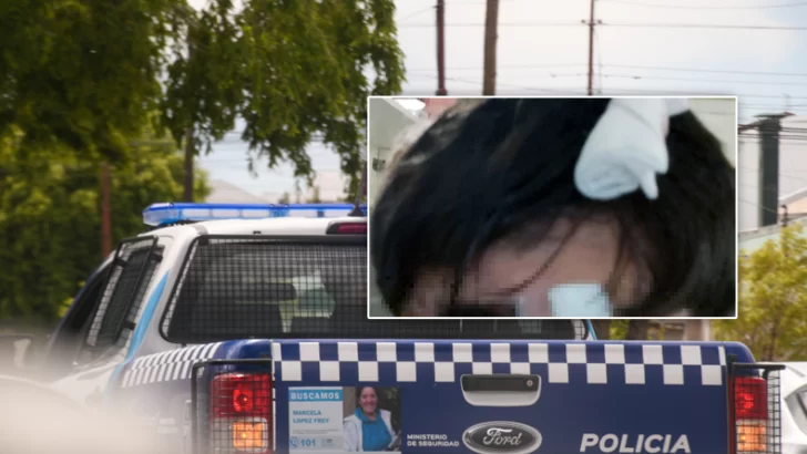 Padres de un joven con discapacidad denunciaron que su hijo fue golpeado por la Policía