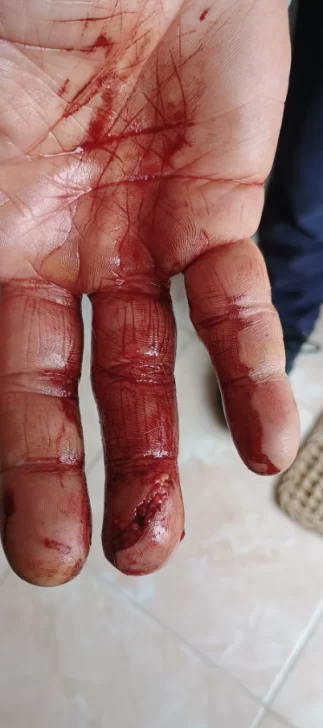 Un pitbull atacó a un cachorro y mordió a un hombre que intentaba defenderlo: &#8220;El dueño ni corrió para agarrarlo&#8221;