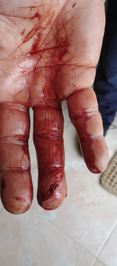 Un pitbull atacó a un cachorro y mordió a un hombre que intentaba defenderlo: &#8220;El dueño ni corrió para agarrarlo&#8221;