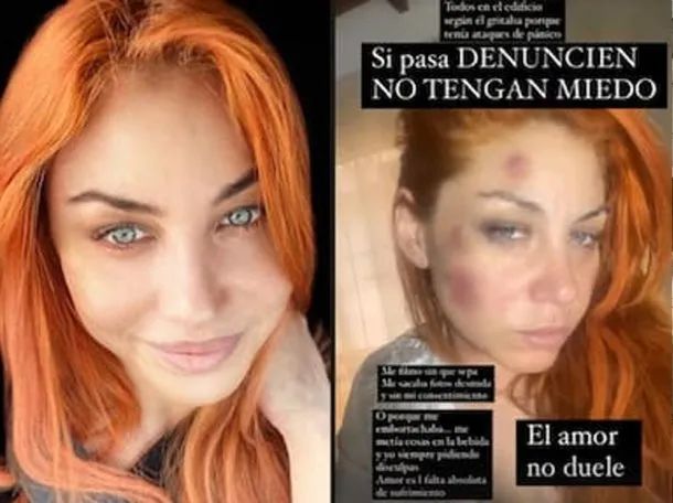 La Oficina de Violencia Doméstica calificó como víctima de &#8220;alto riesgo&#8221; a Lourdes de Bandana
