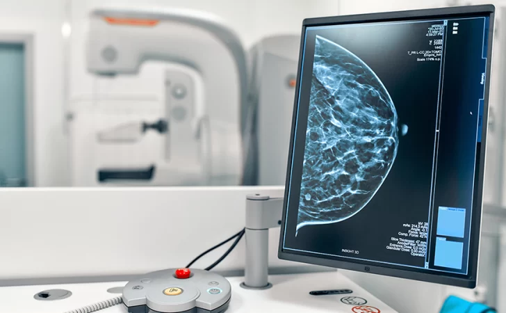  “Desde los 20 años las mujeres deben conocer su cuerpo y familiarizarse con él. Y a los 35, exigir la mamografía. No es una opción, es un derecho”