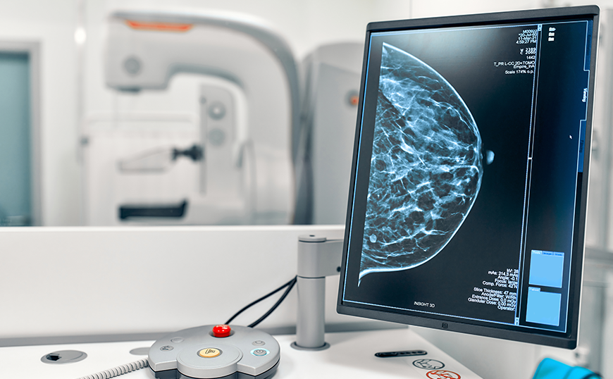  “Desde los 20 años las mujeres deben conocer su cuerpo y familiarizarse con él. Y a los 35, exigir la mamografía. No es una opción, es un derecho”