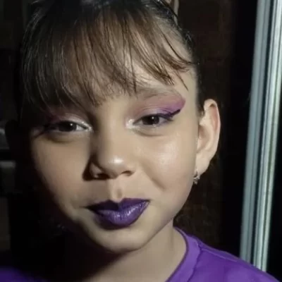 En la Patagonia: nena de 8 años fue atropellada por un patrullero y terminó gravemente herida En la Patagonia: nena de 8 años fue atropellada por un patrullero y terminó gravemente herida