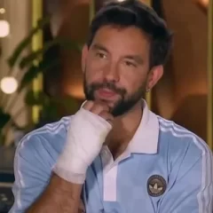 El accidente que sufrió “Cachete” Sierra en MasterChef Celebrity: “¿Qué te pasó… ?”
