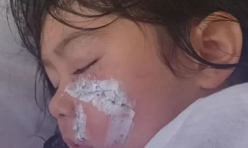 Un perro perseguía a un gato y terminó atacando a una nena en Caleta Olivia Un perro perseguía a un gato y terminó atacando a una nena en Caleta Olivia