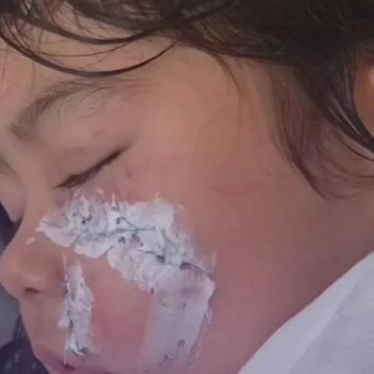 Un perro perseguía a un gato y terminó atacando a una nena en Caleta Olivia Un perro perseguía a un gato y terminó atacando a una nena en Caleta Olivia