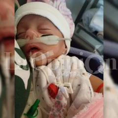 Trigemelas idénticas de Santa Cruz: este martes operarán a Alma, la única que continúa internada